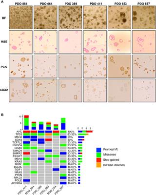 Patient Derived Organoids Confirm That PI3K/AKT Signalling Is an Escape Pathway for Radioresistance and a Target for Therapy in Rectal Cancer